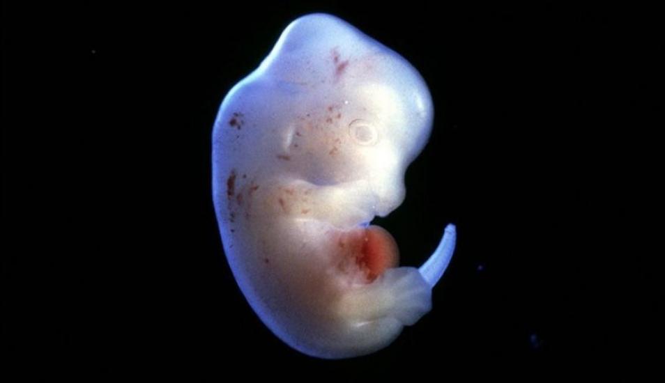 Foto: Science Pictures Ltd / SPL.