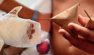 Uso de pirotecnia deja como saldo 19 lesionados, 11 de ellos menores de edad
