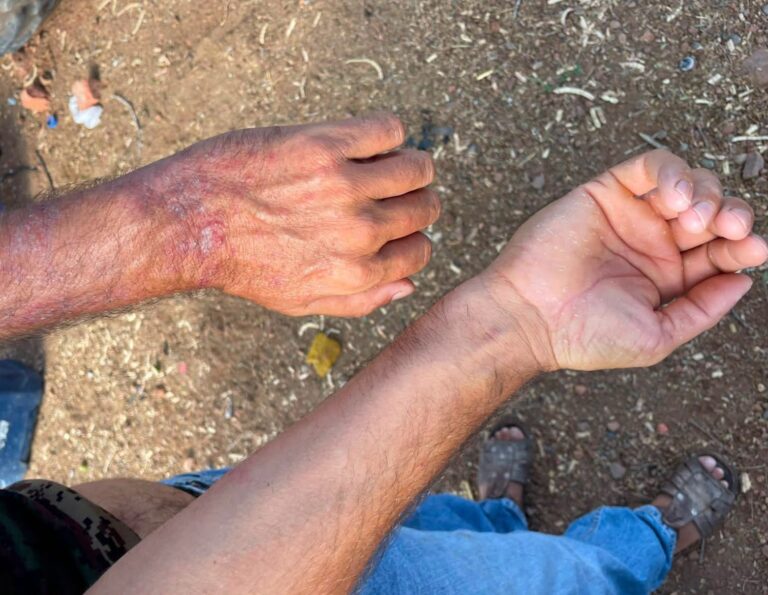 Denuncian brote de enfermedades por agua contaminada en dos comunidades de El Fuerte, Sinaloa Denuncian brote de enfermedades por agua contaminada en dos comunidades de El Fuerte, Sinaloa