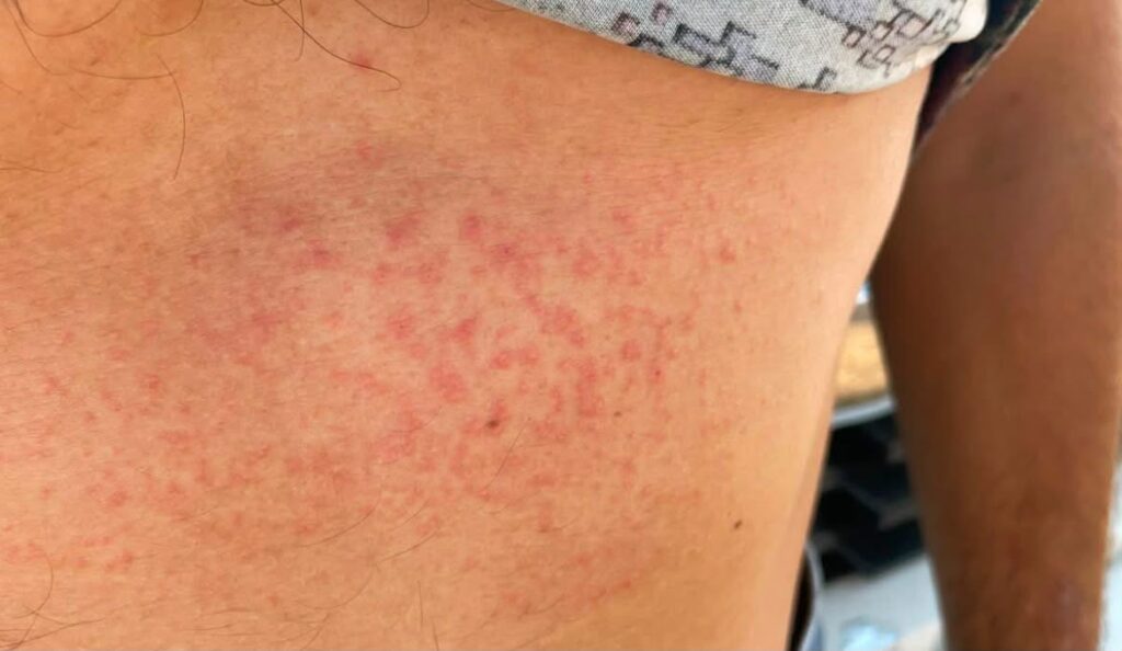 Denuncian brote de enfermedades por agua contaminada en dos comunidades de El Fuerte, Sinaloa