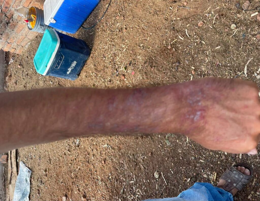 Denuncian brote de enfermedades por agua contaminada en dos comunidades de El Fuerte, Sinaloa